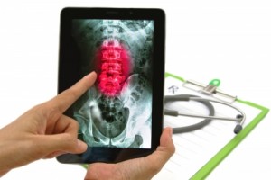 Doctor Looking Lumbar Spine X-ray Image On Tablet For Medical Exam” by Praisaeng